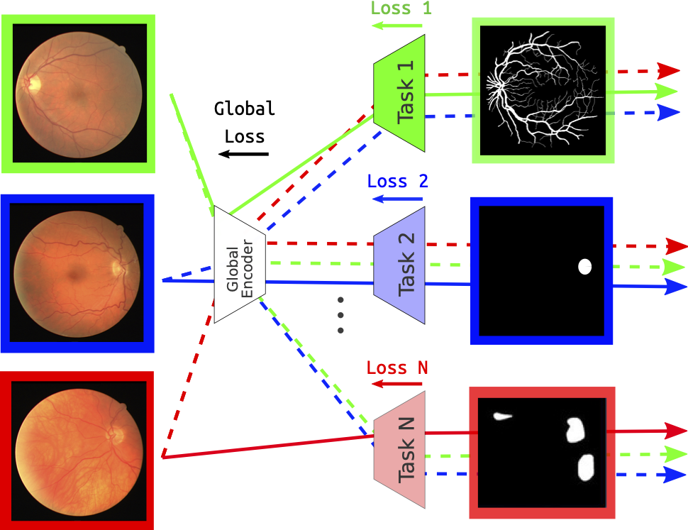 Overview on the multi-task method dealing with segmentation tasks of the eye fundus elements